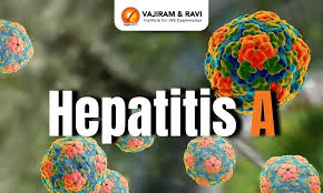 Hepatitis A